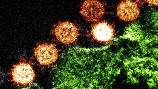 la combinacion de vacuna e infeccion natural da superinmunidad contra el covid-19