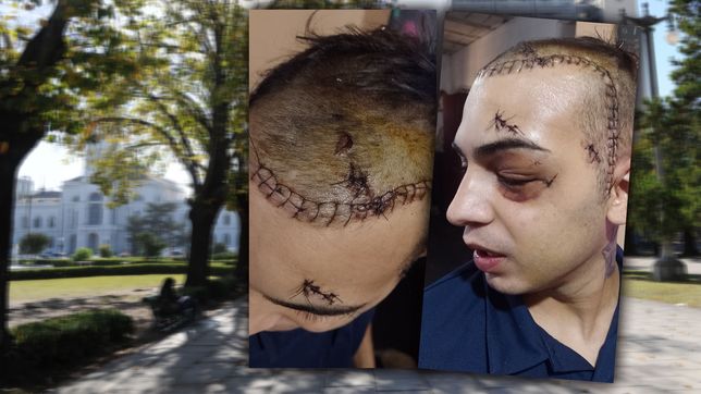 fue desfigurado a golpes en plaza moreno y ahora le tienen que poner una plaqueta de titanio en el craneo