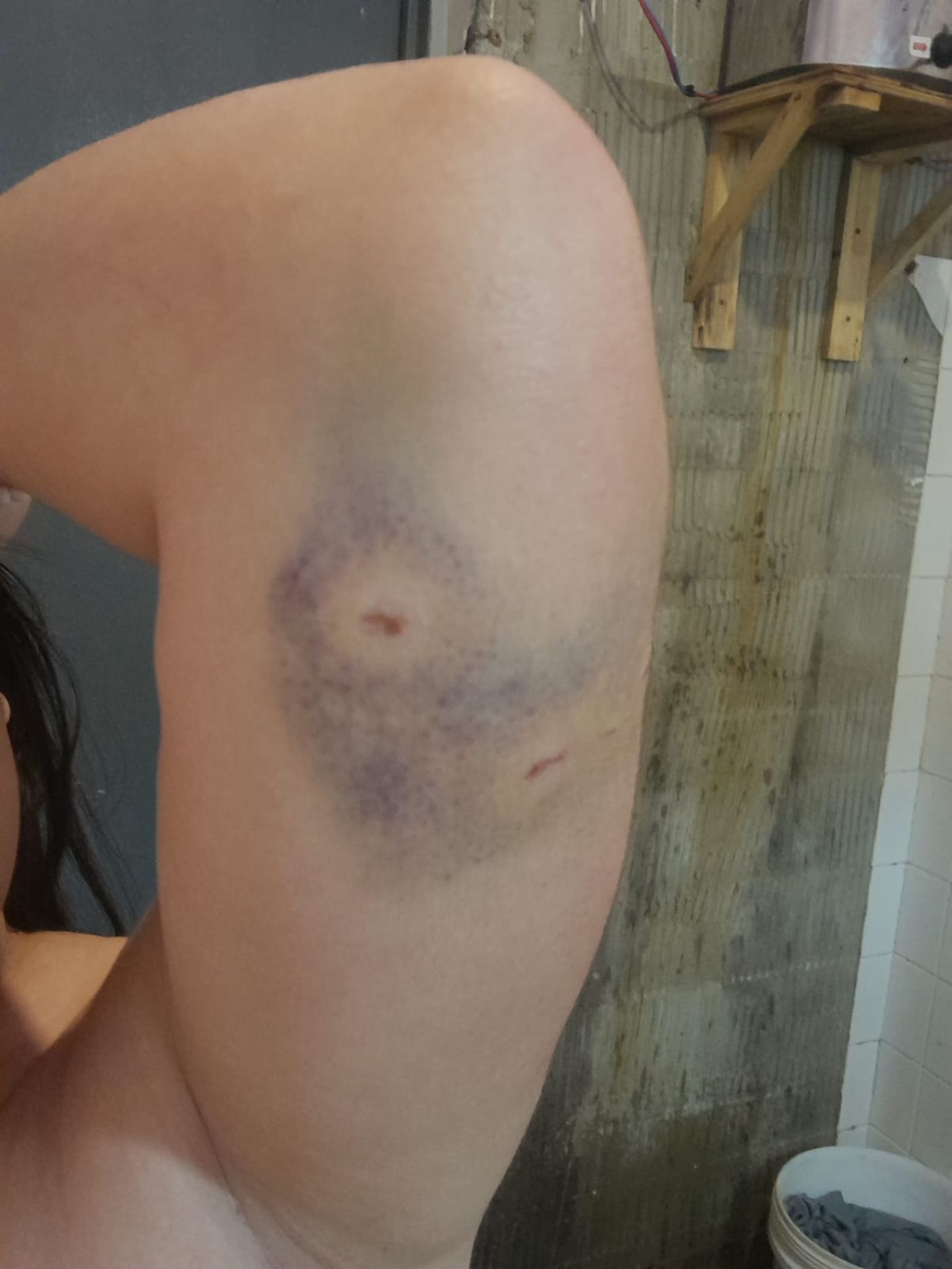 La mujer fue atacada por un perro en Villa Elvira.