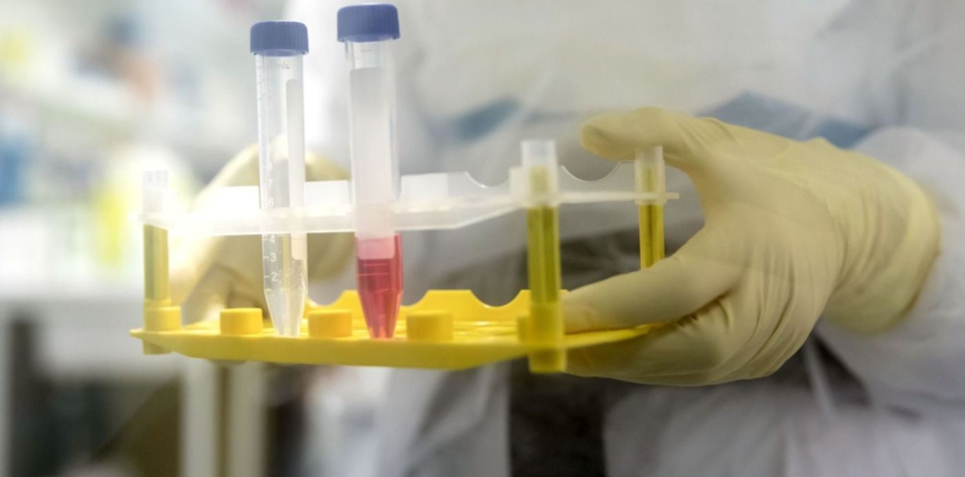 1585424741899.jpeg?rotate=0&scaleX=1&x=0&width=1493&height=747&oh=1000&y=153&scaleY=1&ow=1500&&cw=1920&ch=950