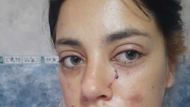 atacaron brutalmente en la plata a una joven que denuncio abusos