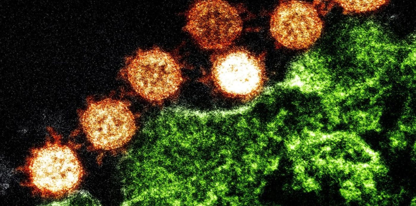 1580068416397.jpg?height=743&scaleX=1&scaleY=1&oh=999&x=7&width=1486&rotate=0&ow=1500&y=200&&cw=1920&ch=950