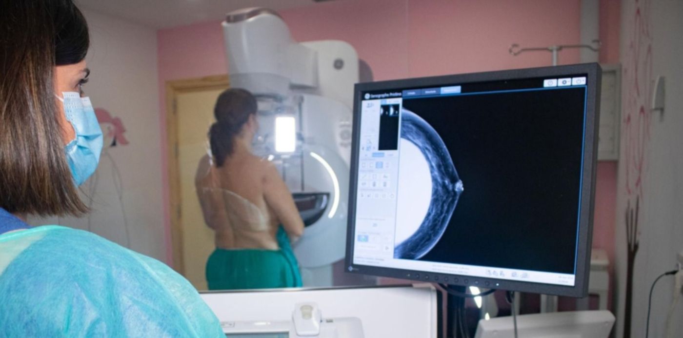 mamografía