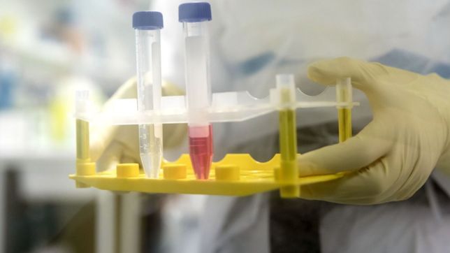 la unlp le presto equipamiento al hospital san juan de dios para hacer tests de coronavirus en la plata