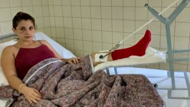 consiguieron un implante para que una joven atropellada en la plata vuelva a caminar