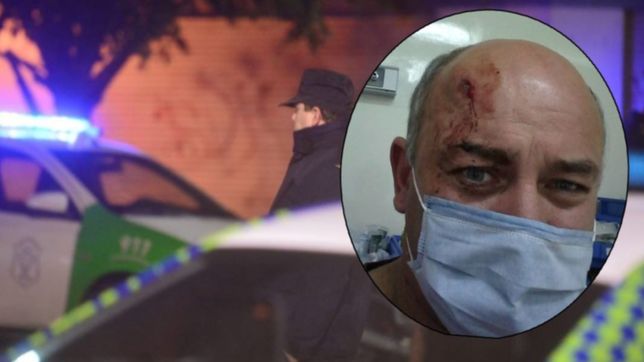 tolosa: balearon a un hombre en la cabeza y se salvo de milagro