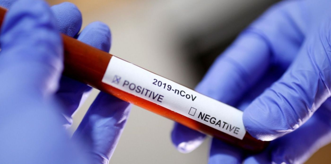 1585424732867.jpg?x=11&y=101&width=1485&height=743&rotate=0&scaleX=1&scaleY=1&ow=1500&oh=995&&cw=1920&ch=950