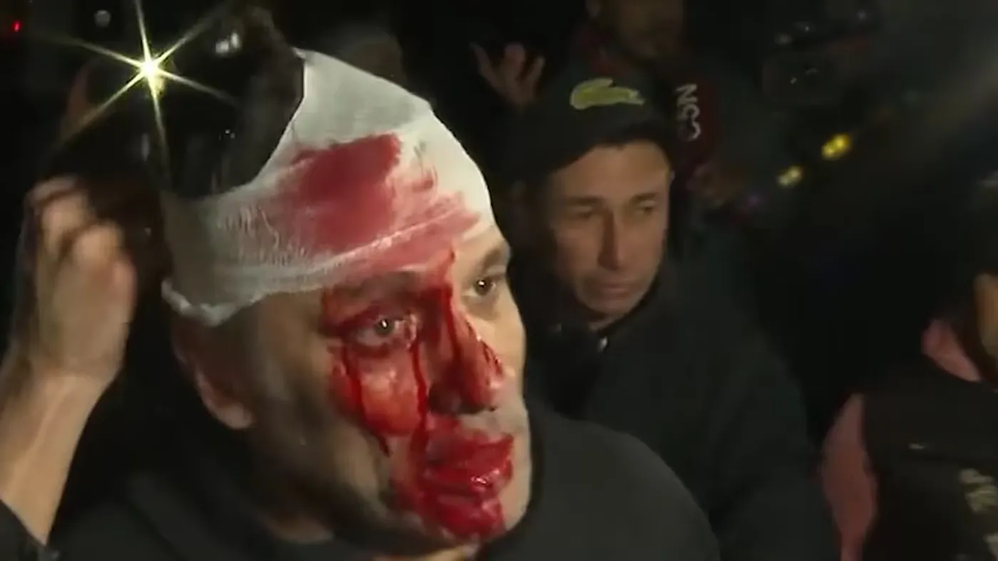 El periodista herido durante el acto de Javier Milei en Moreno
