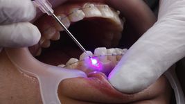 la facultad de odontologia suma un servicio para pacientes de alta complejidad la facultad de odontologia suma un servicio para pacientes de alta complejidad