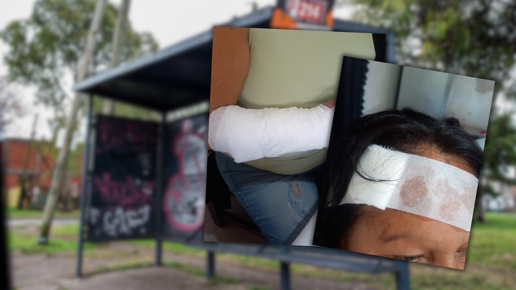 Fracturaron a una mujer y le abrieron la cabeza mientras esperaba el micro