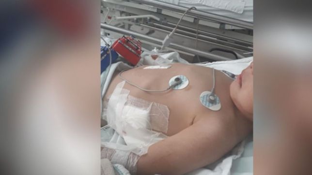 asi fue el dramatico ataque de tres perros a un nene que casi termina en tragedia