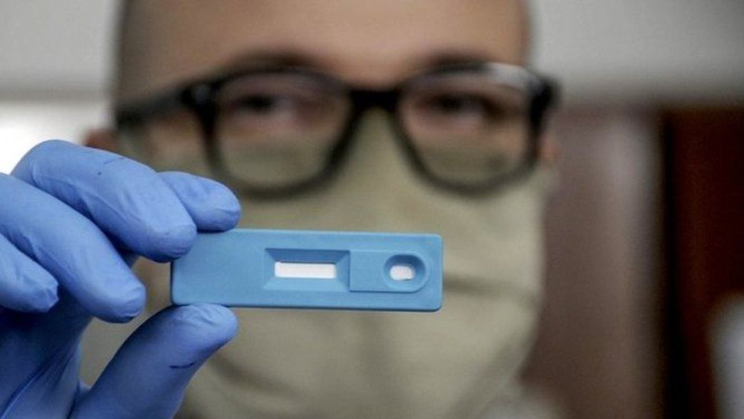 Laboratorios de análisis ratifican oposición a la venta libre de test rápidos de COVID