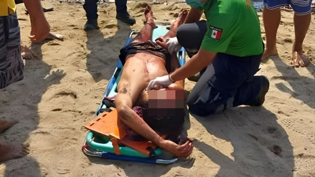 Brutal ataque a machetazos a tres argentinos en una playa de México