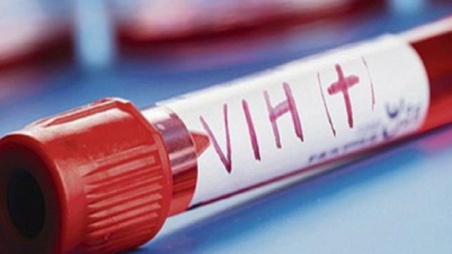 cientificos dan por curado el segundo caso de vih en el mundo