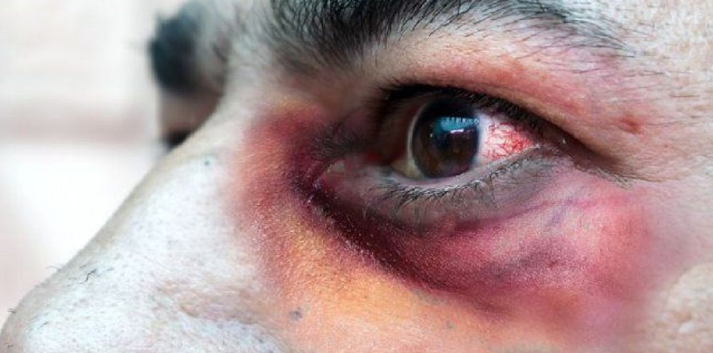 1622224408298.jpg?x=2&y=101&width=640&height=320&rotate=0&scaleX=1&scaleY=1&ow=644&oh=459&&cw=1920&ch=950