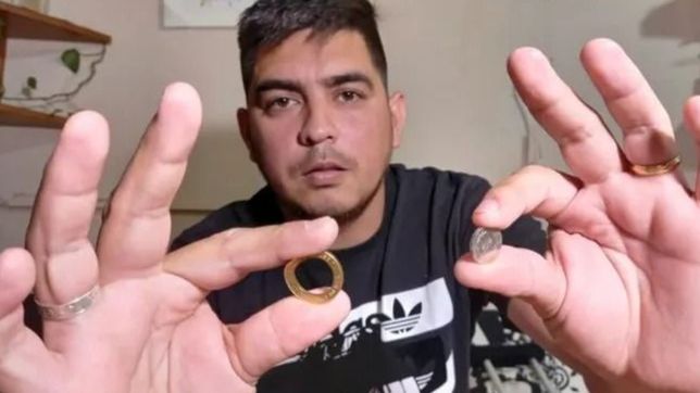 asalto, disparo y milagro: una moneda salvo a un joven de la muerte