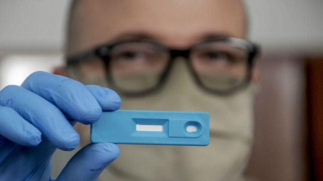 asi funciona el test rapido de covid-19 que creo la unlp