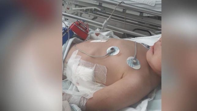 el nene atacado por tres perros sigue internado en terapia