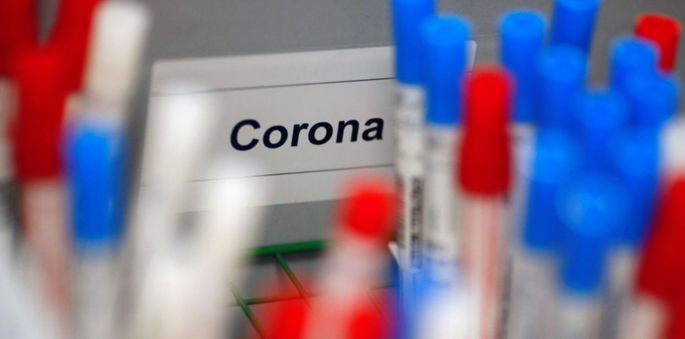 1585424739927.jpg?rotate=0&ow=1500&oh=1000&height=748&scaleX=1&scaleY=1&x= 10&y=60&width=1497&&cw=1920&ch=950