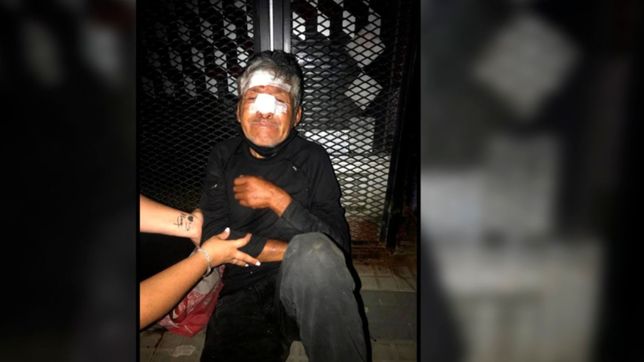 revuelo en el centro platense por un indigente herido al que dejaron tirado en la calle
