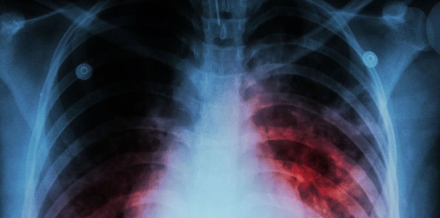 1664029737471.jpg?x= 7&y=66&width=1500&height=750&rotate=0&scaleX=1&scaleY=1&ow=1500&oh=999&&cw=1920&ch=950