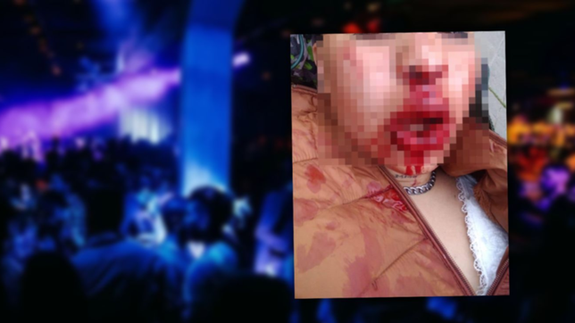 brutal ataque y golpes a dos mujeres a la salida de un boliche de berisso