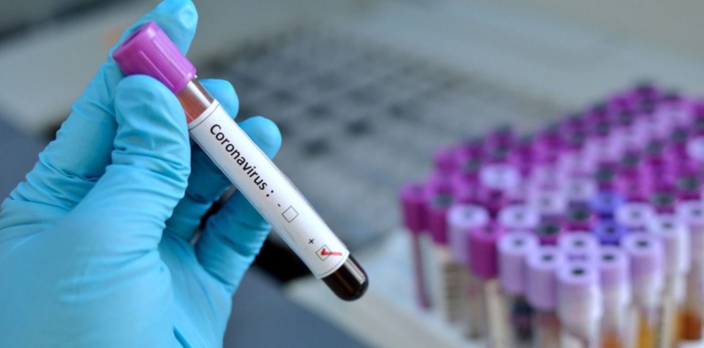 1584104954298.jpg?y=14&width=1483&scaleY=1&x=3&rotate=0&scaleX=1&ow=1500&oh=849&height=742&&cw=1920&ch=950