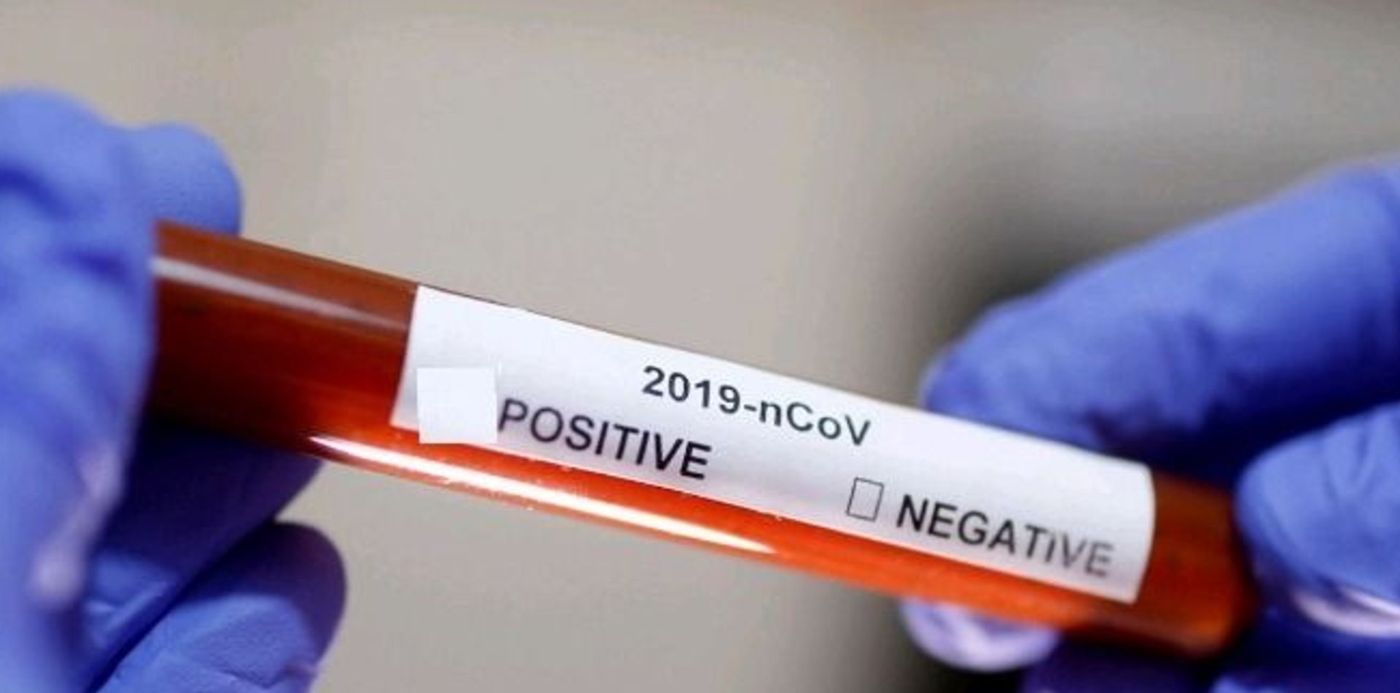 1582918552843.jpg?width=651&height=325&scaleY=1&ow=669&oh=457&x=14&y=43&rotate=0&scaleX=1&&cw=1920&ch=950