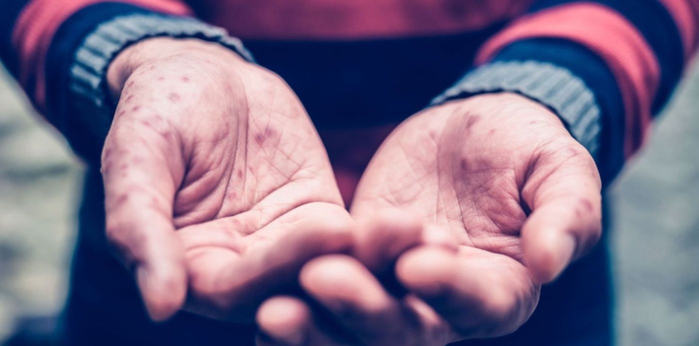 1653314250499.jpg?x=0&y=11&width=1500&height=750&rotate=0&scaleX=1&scaleY=1&ow=1500&oh=843&&cw=1920&ch=950