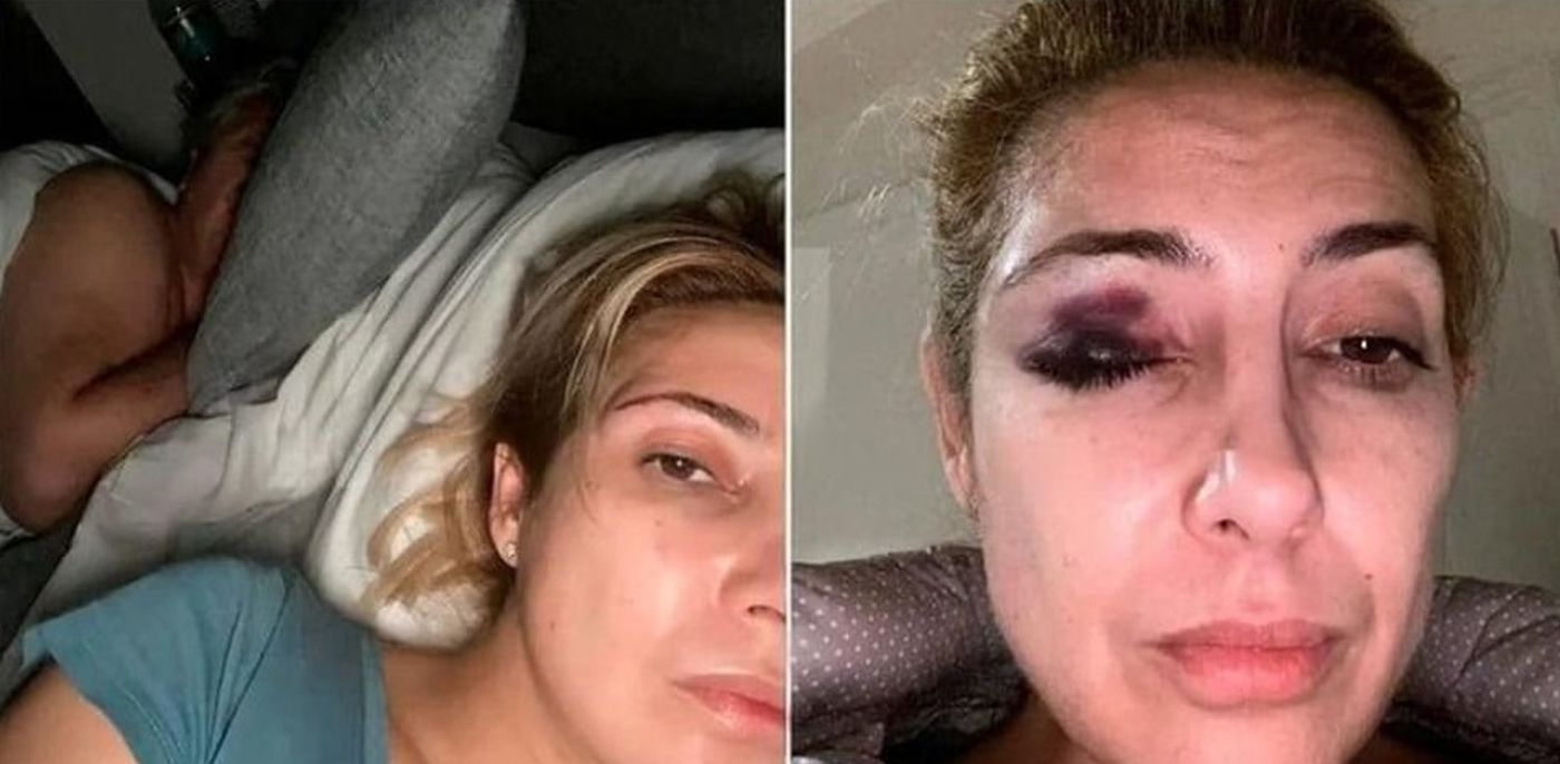 Algunas de las imágenes que Fabiola Yañez aportó a la causa contra Alberto Fernández por violencia de género