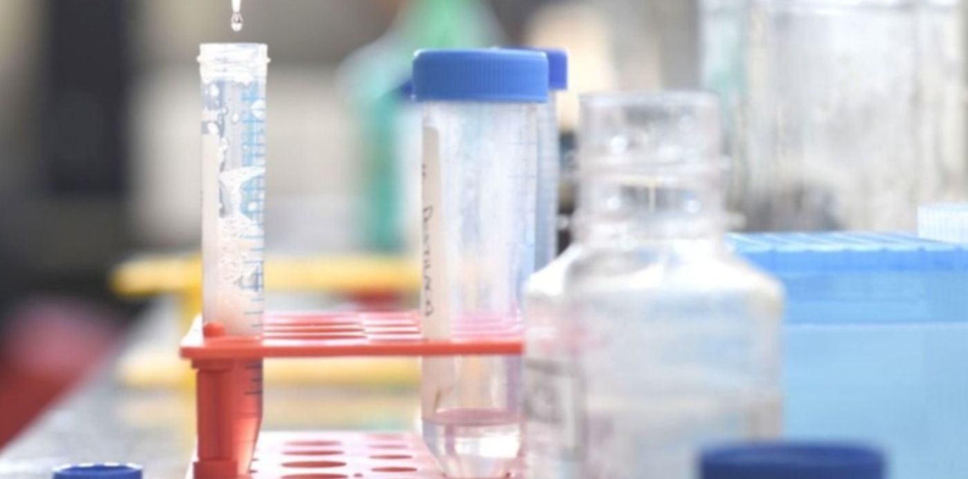 1606499054466.jpg?x=4&y=106&width=954&height=477&rotate=0&scaleX=1&scaleY=1&ow=960&oh=640&&cw=1920&ch=950