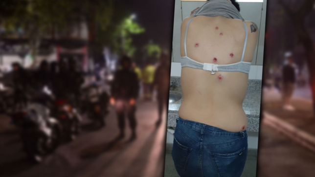 la historia de la hincha del lobo que recibio nueve balazos de goma durante la represion