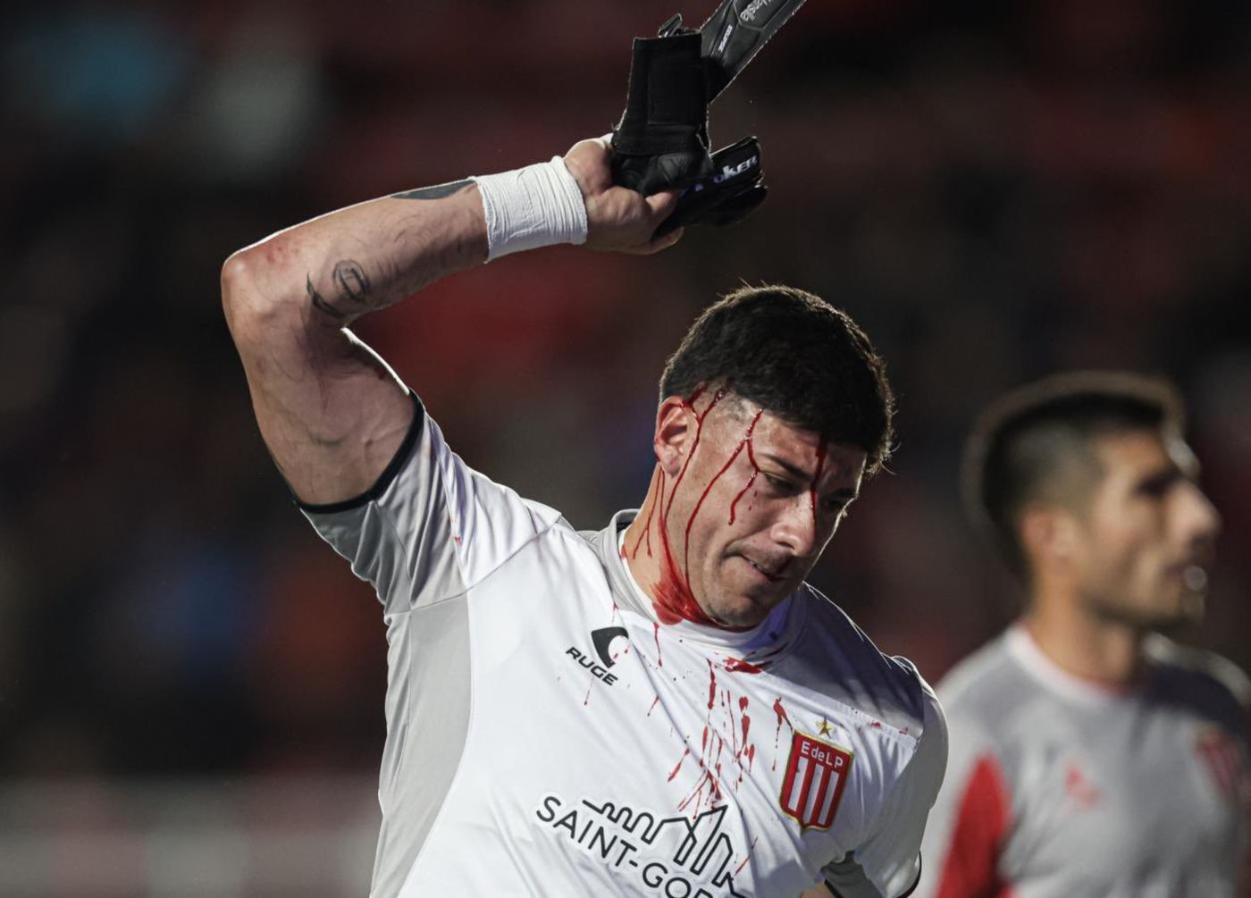 Estudiantes San Lorenzo Mansilla sangre.jpg