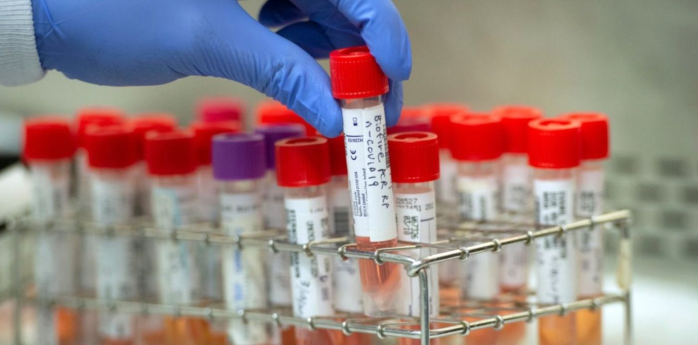 1585424745790.jpeg?x=8&width=1484&height=742&rotate=0&scaleX=1&scaleY=1&ow=1500&y=45&oh=968&&cw=1920&ch=950