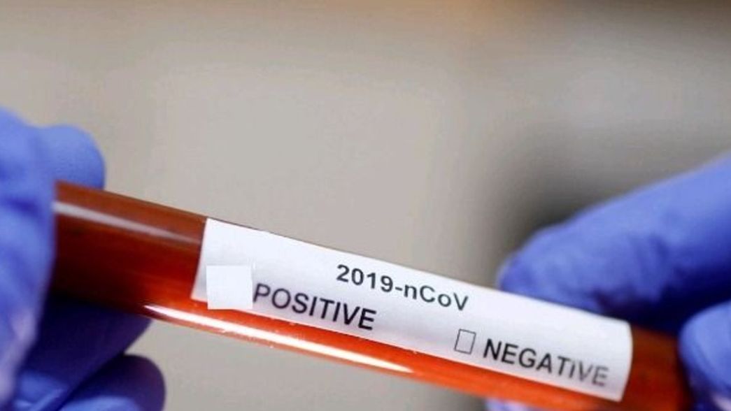 Coronavirus: quienes viajaron al exterior podrán tomarse una licencia extraordinaria