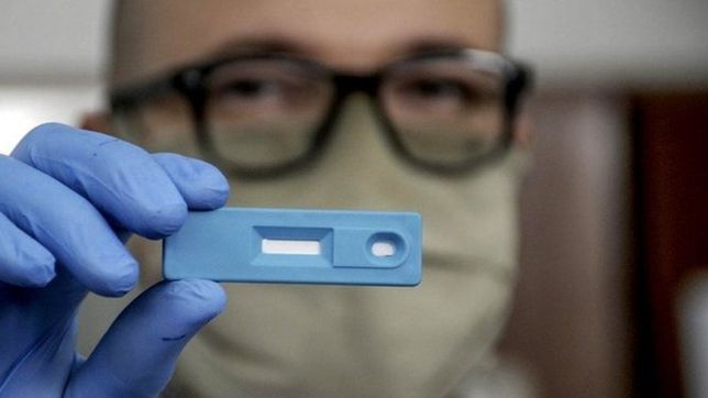 la anmat aprobo el test rapido de covid-19 argentino desarrollado en la unlp