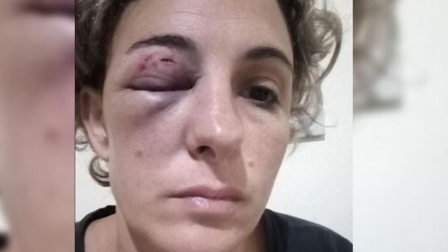 brutal robo en una panaderia de la plata: una empleada fue atacada y casi pierde un ojo