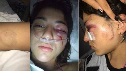 Golpeó a su ex y la amenazó: No me importa ir preso, te voy a matar