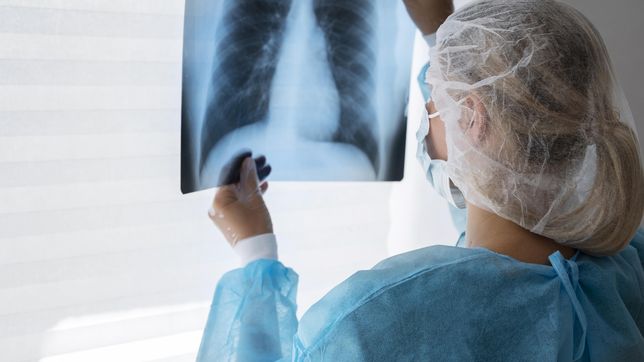 crecen los casos de tuberculosis y la provincia de buenos aires concentra la mayor cantidad