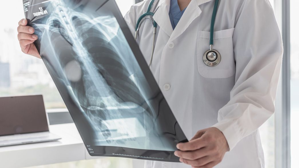 Aumentaron los casos de tuberculosis en Argentina y advierten sobre los riesgos de la baja vacunación