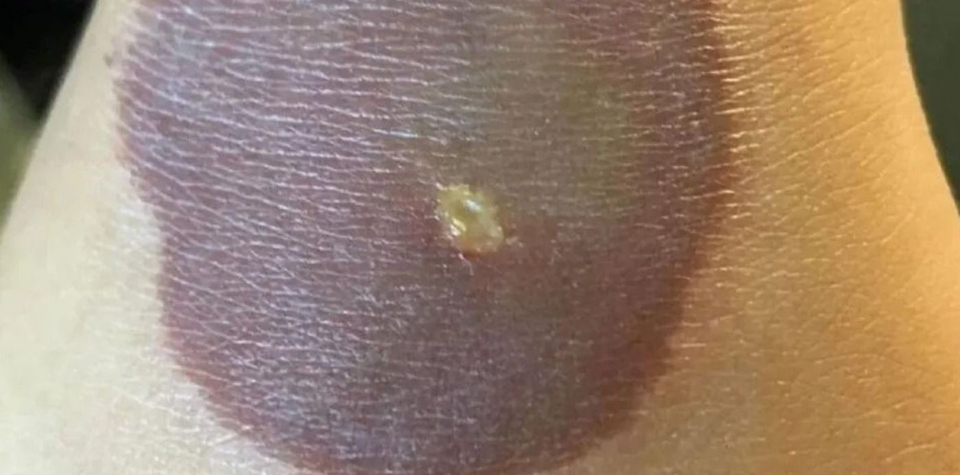 1655737605131.jpg?x=11&y=3&width=950&height=475&rotate=0&scaleX=1&scaleY=1&ow=970&oh=546&&cw=1920&ch=950