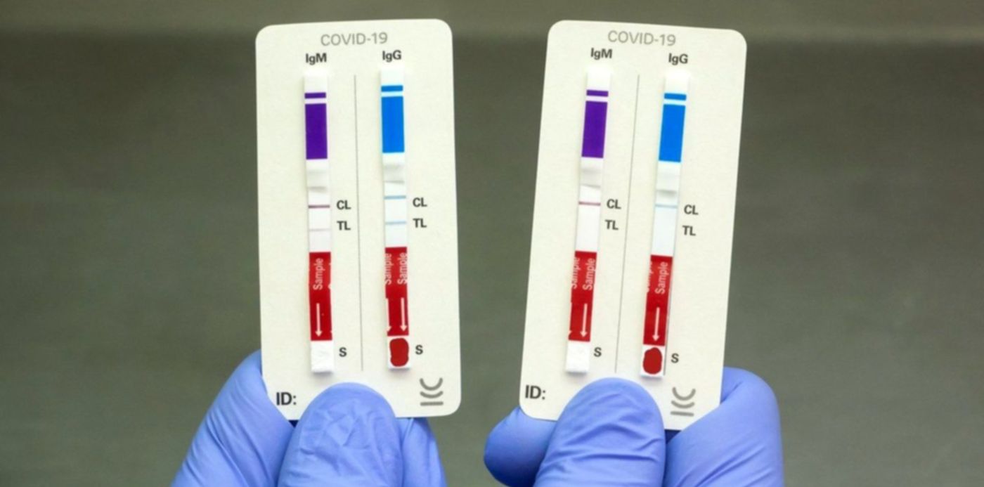 test Chemstrip Covid19
