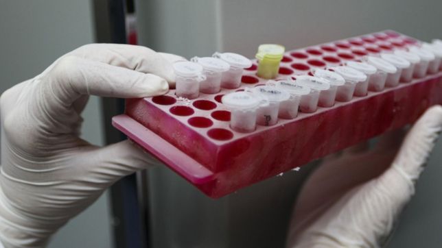 ¿cuales son los diez principales sintomas de una posible hepatitis?