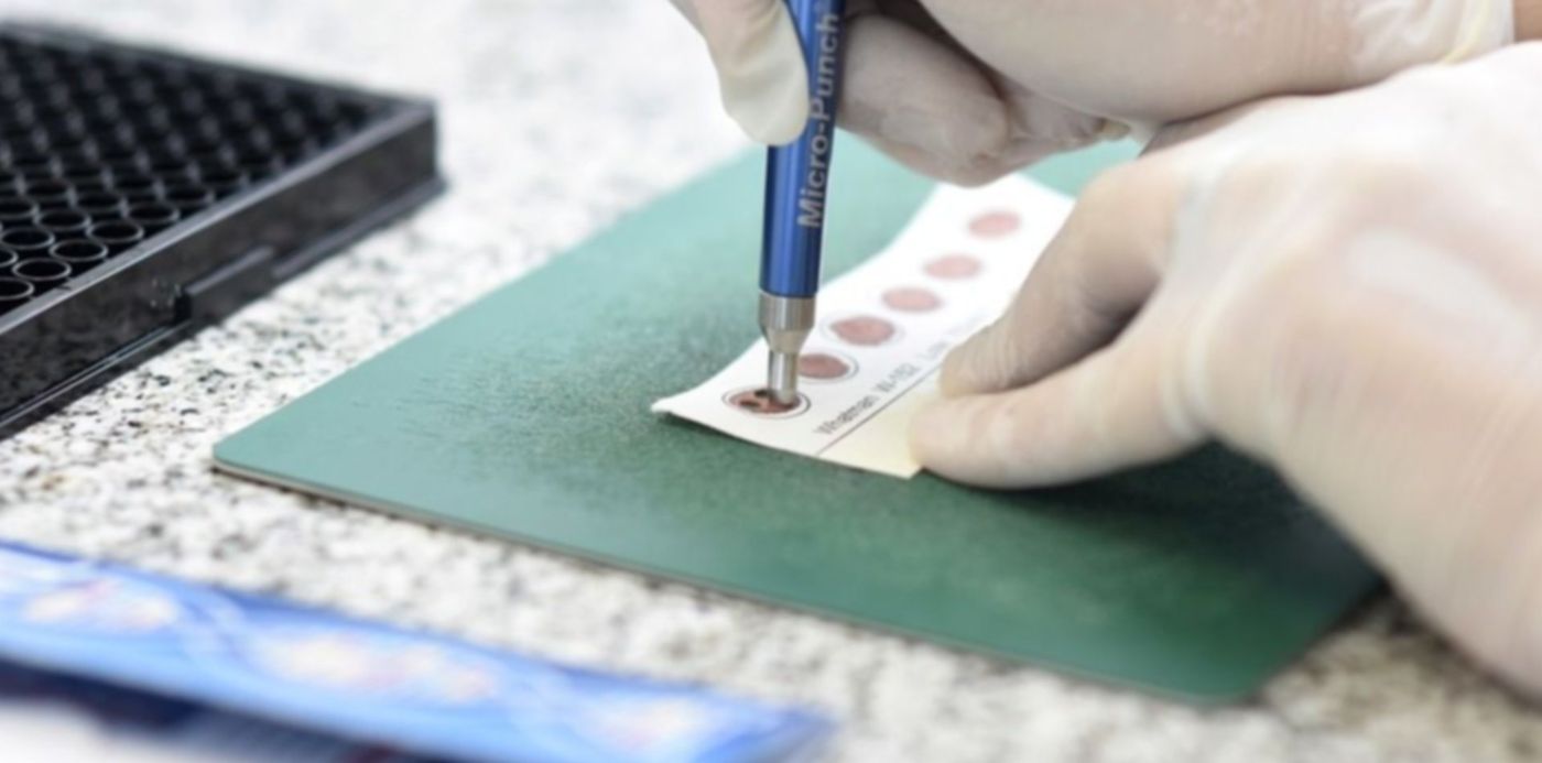 1583271220399.jpg?width=949&rotate=0&ow=960&oh=640&x=6&y=119&height=475&scaleX=1&scaleY=1&&cw=1920&ch=950