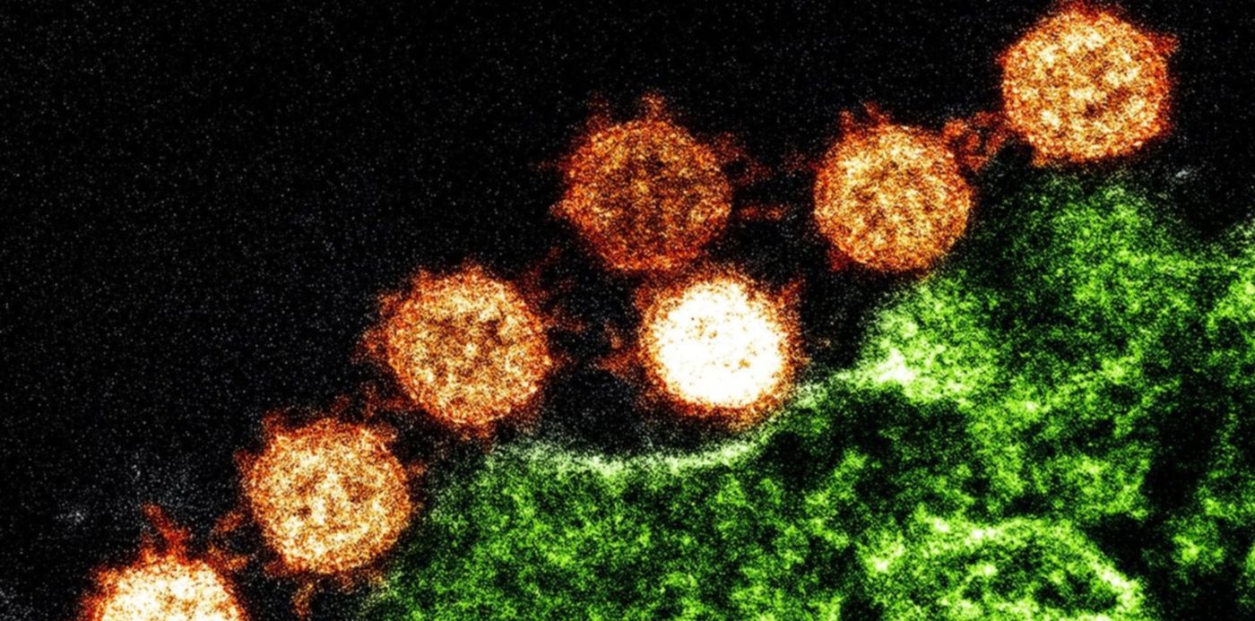 1580068416397.jpg?x=3&y=53&width=1493&height=747&rotate=0&scaleX=1&scaleY=1&ow=1500&oh=999&&cw=1920&ch=950