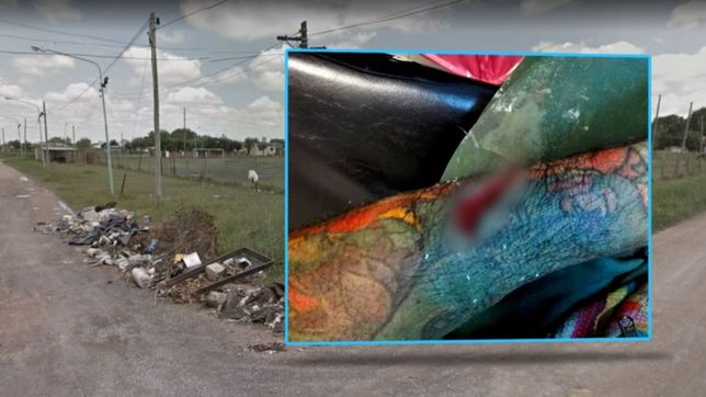 somos humanos, no maquinas, el pedido de un recolector de basura que se corto el brazo