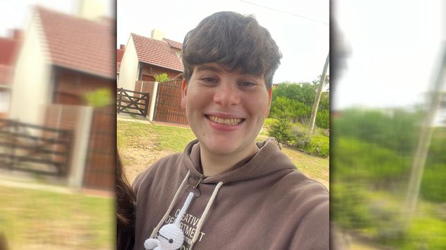 es de la plata, tuvo un accidente en moto y necesita dos protesis para volver a caminar