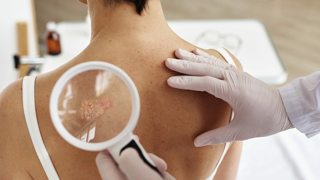 pami la plata brindo una charla sobre salud dermatologica para adultos mayores