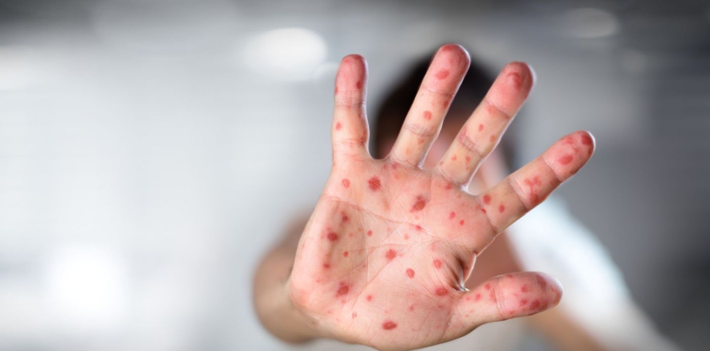 1532117219017.jpg?&cw=1920&ch=950