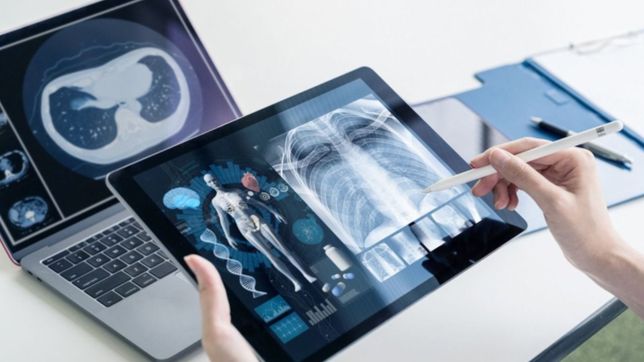 provincia lanzo una red de diagnostico por imagen y segundas opiniones por teleconsulta